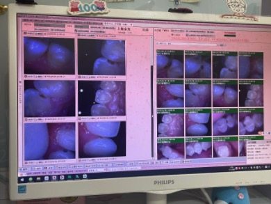 上海科瓦齿科看牙