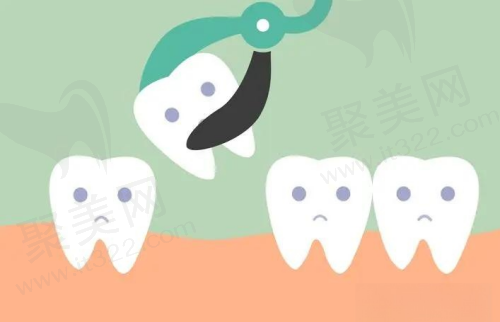 拔牙收费价格差异大的原因有哪些