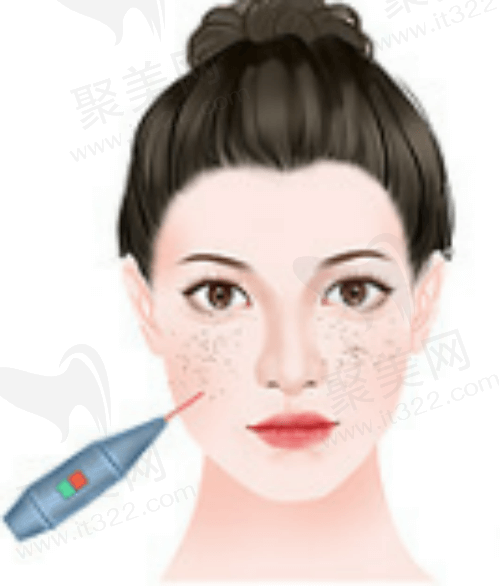 雷射去斑的副作用