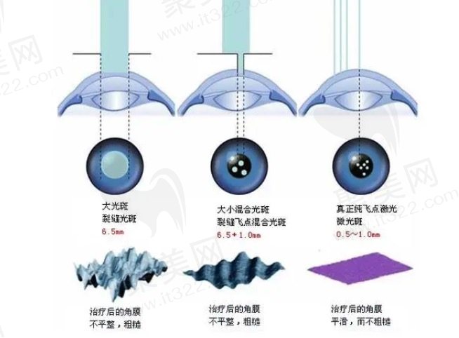激光矫正近视眼手术可能存在的危害和后遗症有哪些？