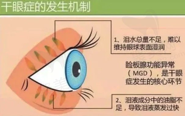 干眼症与“不死的癌 症”