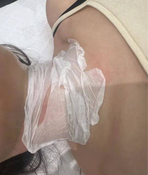 杭州上颜医疗美容怎么样