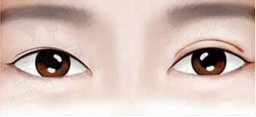 刘志刚医生眼修复手术价格多少