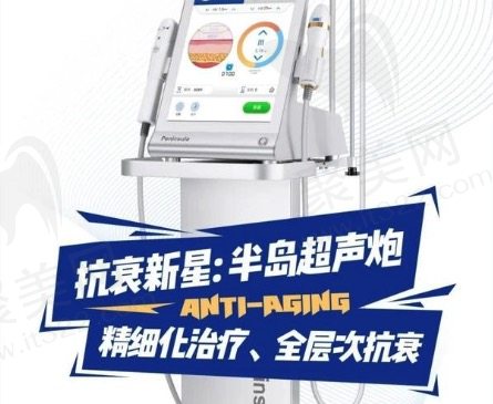 超声炮的价格