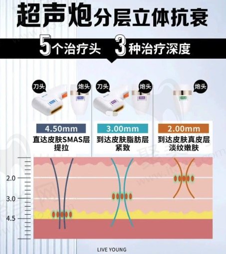 做一次超声炮的价格是多少钱？