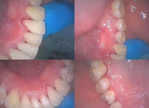 郑州友善口腔怎么样