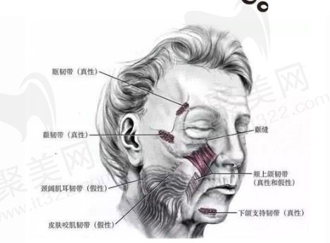 面部筋膜提拉术可靠吗