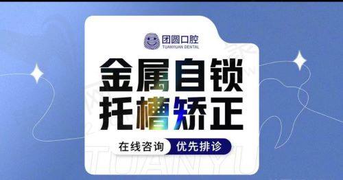 成都团圆口腔牙齿矫正怎么收费