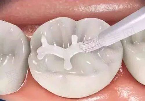 天津南开中牙口腔医院补牙顾客真实反馈