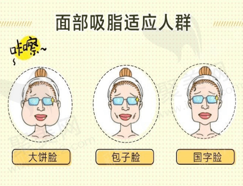 面部吸脂适应人群