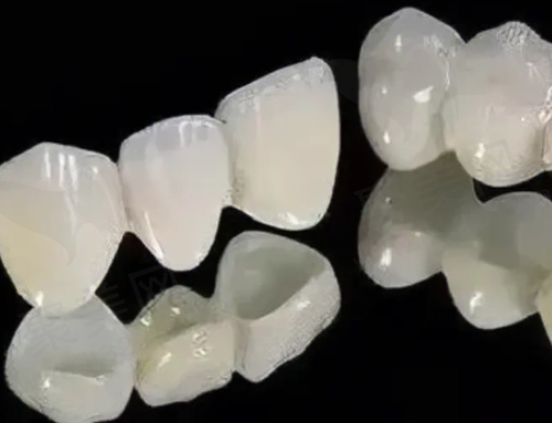 全瓷牙的使用时间是多久