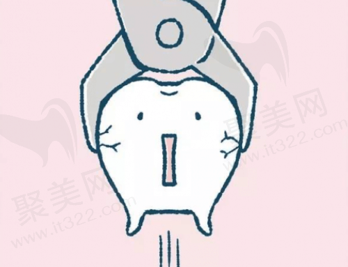 拔智齿的价格