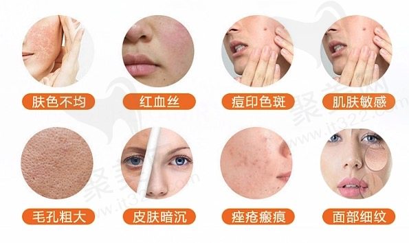 公布正规医院光子嫩肤价格一览表