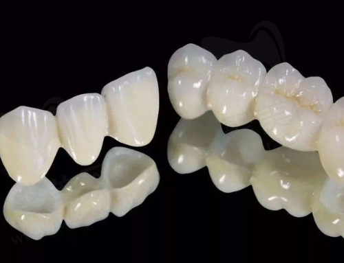 十大进口全瓷牙品牌排名