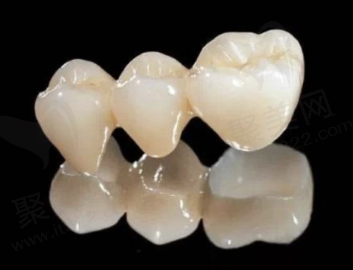 全瓷牙价格