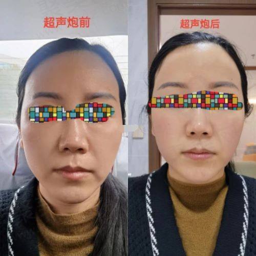 北京冰新丽格医疗美容面部年轻化技术怎么样