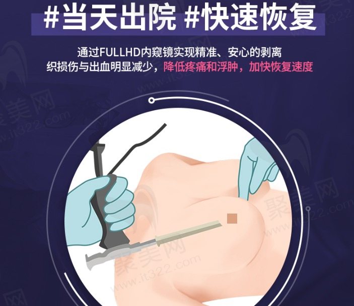 韩国TS整形医院假体隆胸特色
