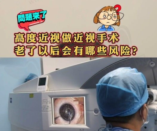 做近视手术优点有哪些？
