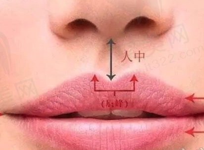 人中缩短手术多少钱？