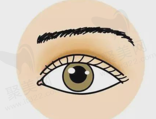 双眼皮修复 双眼皮修复