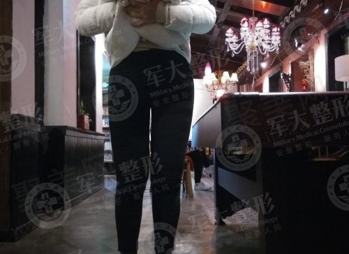 成都军大整形蒲小兵吸脂怎么样