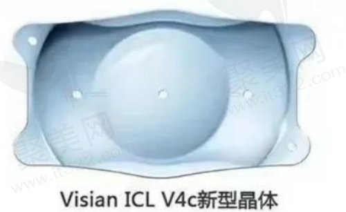 ICL晶体植入