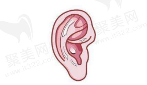吴辉医生做鼻子怎么样