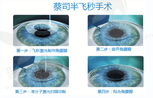 为什么大家都选择珠海希玛林顺潮眼科医院呢？
