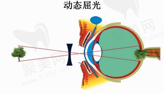 近视眼手术可以报销医疗保险吗？