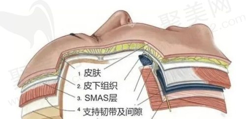 轮廓固定提升能保持多久