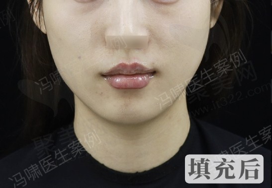 冯啸医生打嘴巴