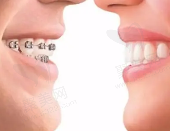 佛山排名前十做牙齿矫正好的医院有哪些
