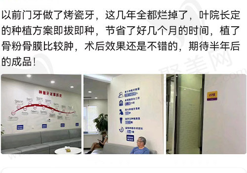 杭州西湖口腔医院种牙评价