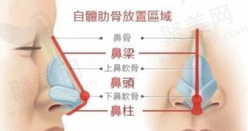 广州韩妃整形医院