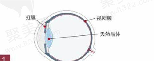 东莞光明眼科医院近视眼手术多少钱》