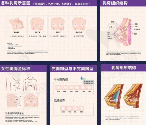 胸形结构