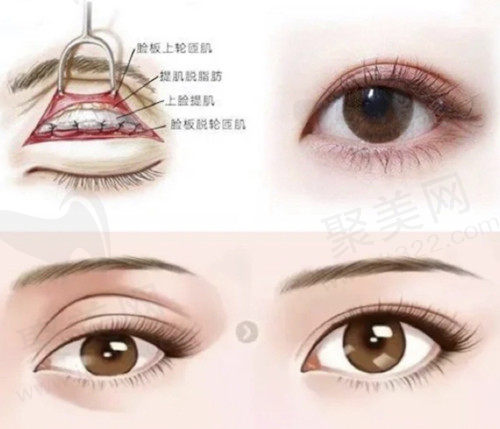 太原华晋医院整形科