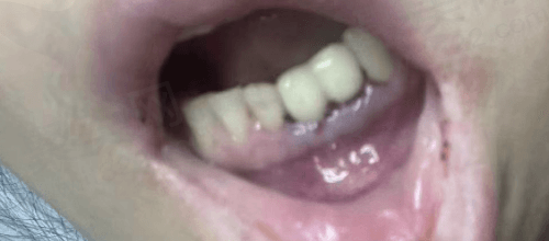 分享我在北京劲松口腔医院的亲身经历
