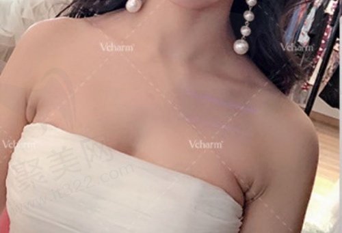 重庆当代整形牙祖蒙隆胸怎么样