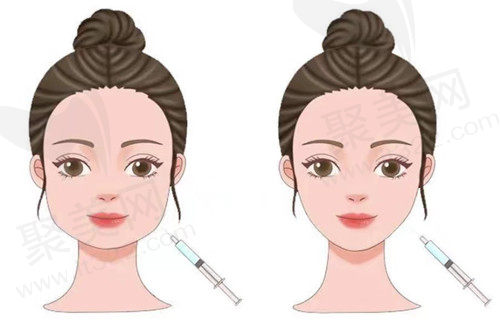 童颜针和玻尿酸一样吗？