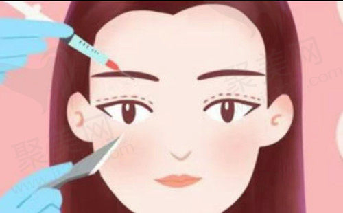 童颜针是什么？