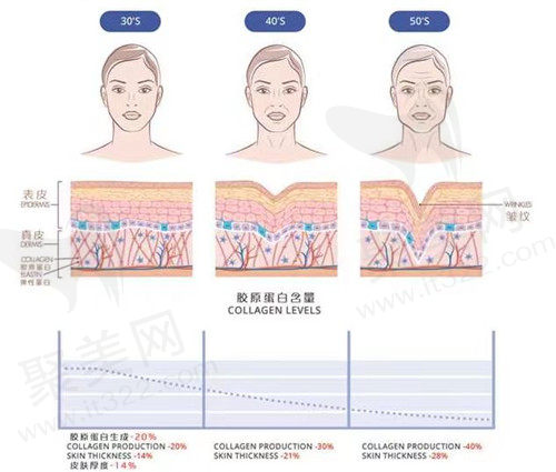 童颜针可以维持多久