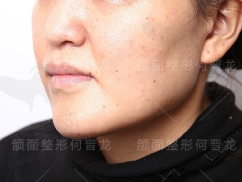上海时光何晋龙做正颌怎么样