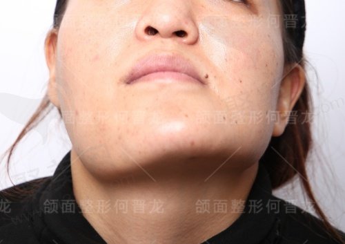 上海时光何晋龙做正颌靠谱吗