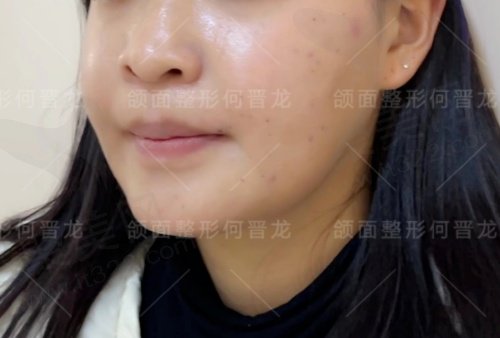 上海时光何晋龙做正颌技术好