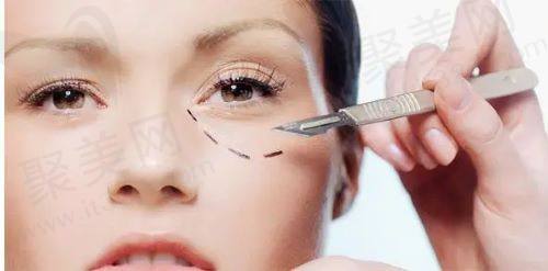 上海华美侣同帅做双眼皮技术怎么样 上海华美侣同帅做双眼皮技术怎么样