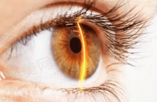 广州视百年眼科医院双频睛雕超薄瓣飞秒有哪些优势？