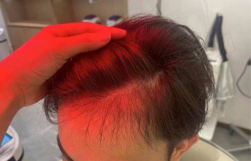 深圳九州植发医院怎么样