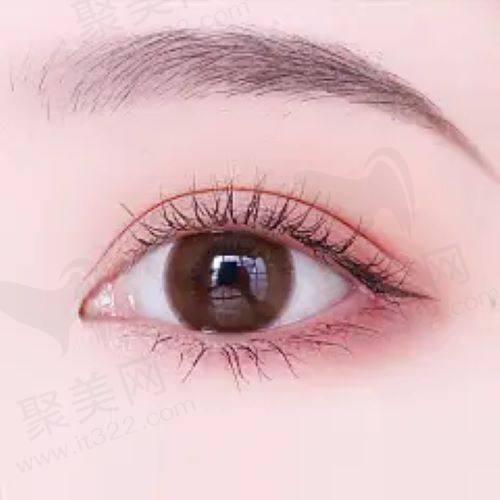 上海华美陈小剑医生做眼修复手术好吗? 上海华美陈小剑医生做眼修复手术好吗?