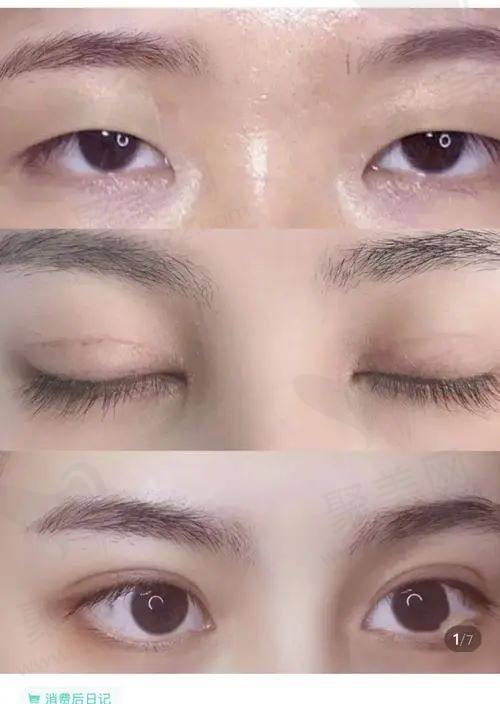 上海华美陈小剑医生手术价格 上海华美陈小剑医生手术价格